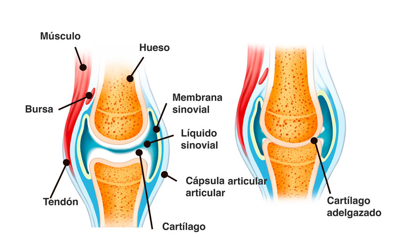 Articulaciones